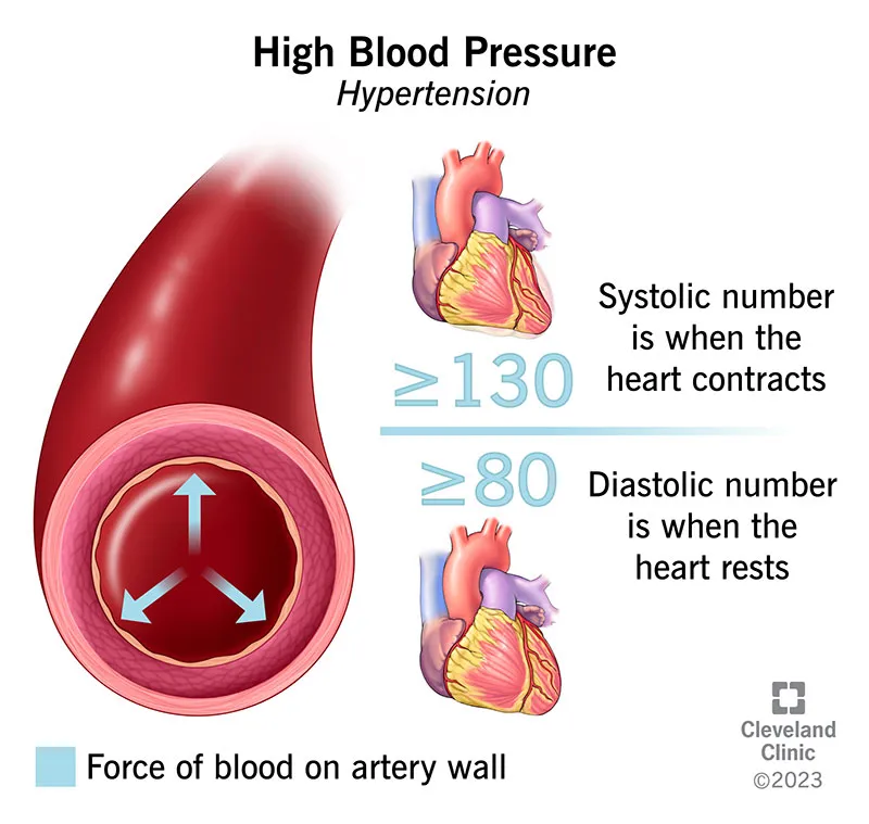 Blood Pressure Measurement